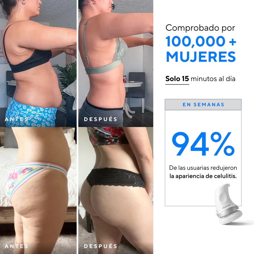 Antes y después de usar Vibro Sculpt en abdomen y glúteos