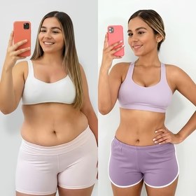 Antes y después con Vibro Sculpt en abdomen y cintura