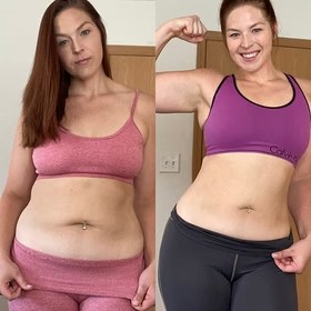 Antes y después con Vibro Sculpt en abdomen