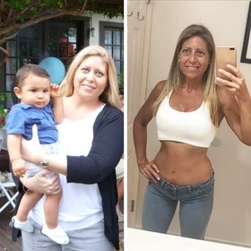 Antes y después con Vibro Sculpt en abdomen y cintura