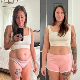 Antes y después con Vibro Sculpt en abdomen