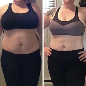 Antes y después con Vibro Sculpt en abdomen